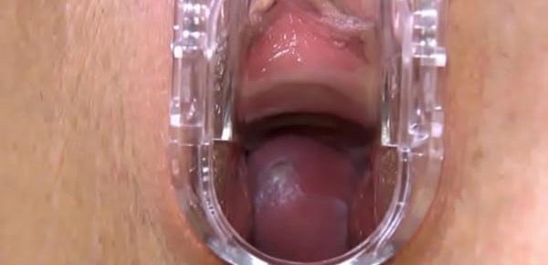  Gyno dildo and hard vagina opening